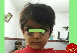 1565905095 4862 - تحقیق کودک آزاری