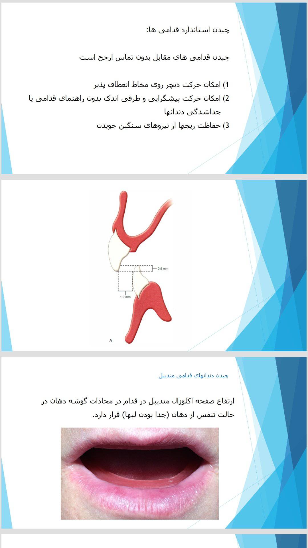 1573106310 4425 - پاورپوینت چیدن دندانهای دنچر