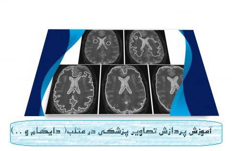فیلم های آموزشی پردازش تصاویر پزشکی در نرم افزار متلب 1575045957 8148 - فیلم های آموزشی پردازش تصاویر پزشکی در نرم افزار متلب