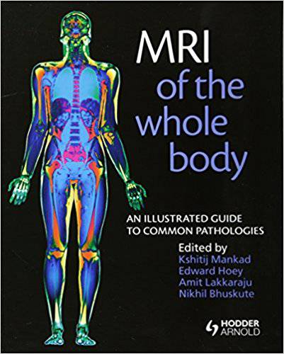 1576406779 8388 - MRI of the Whole Body