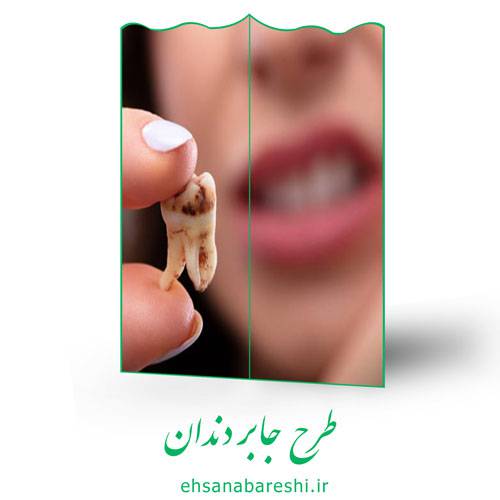 طرح جابر دندان