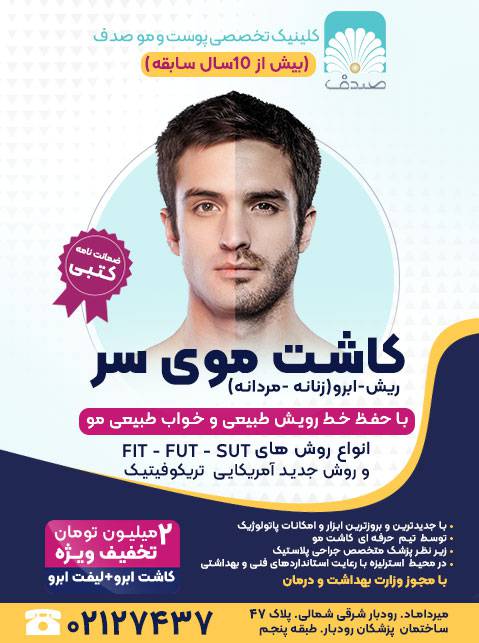 تراکت کاشت مو