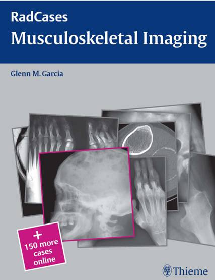 کتاب Musculoskeletal Radiology
